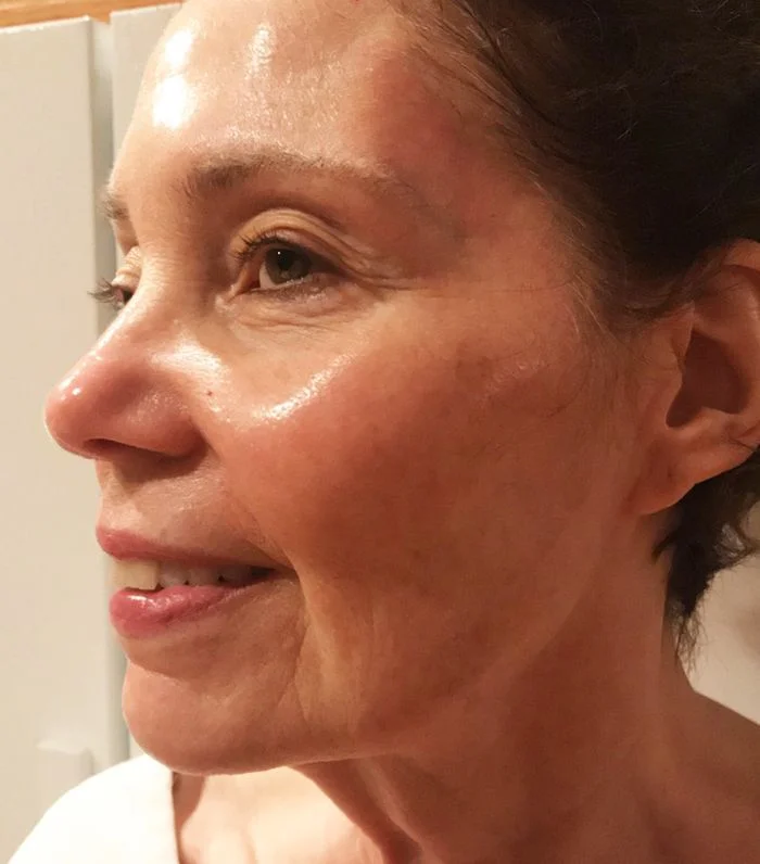 Close-up of a woman's face with a slight smile, showing clear skin.
