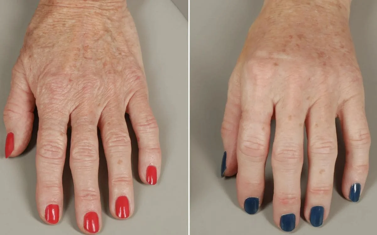 Two hands with red and blue nail polish respectively.