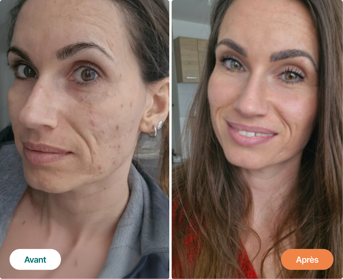 Side-by-side comparison of a woman before and after skincare treatment.
