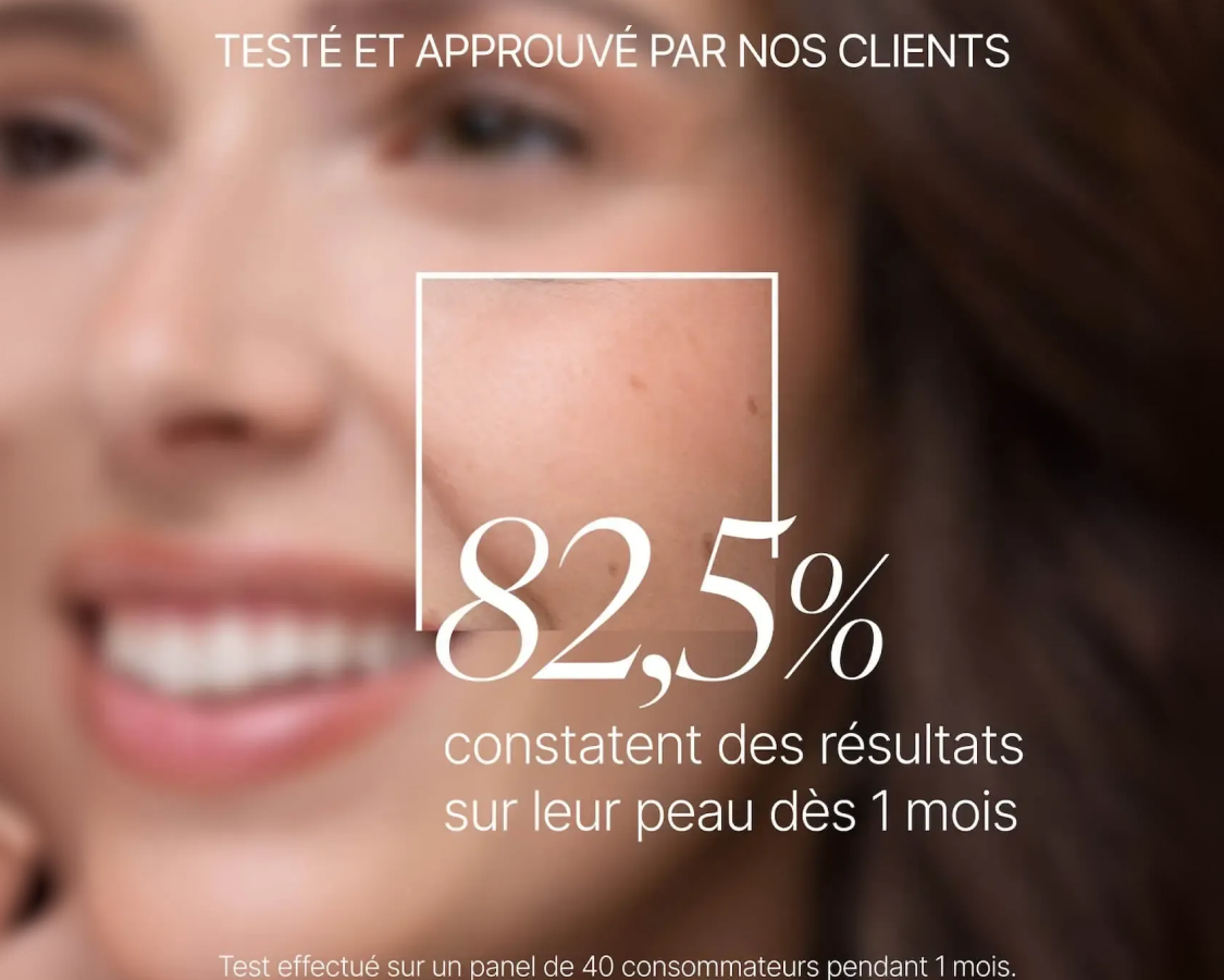 A close-up of a woman's smiling face with text in French highlighting an 82.5% result on her skin.