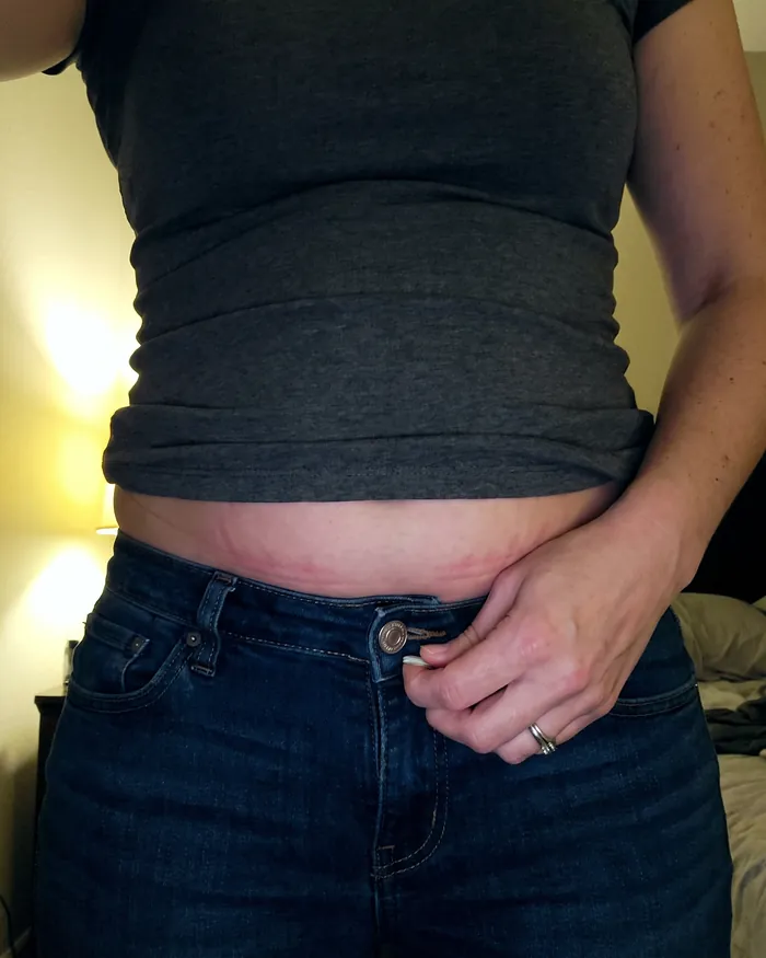 Jeans that won't button