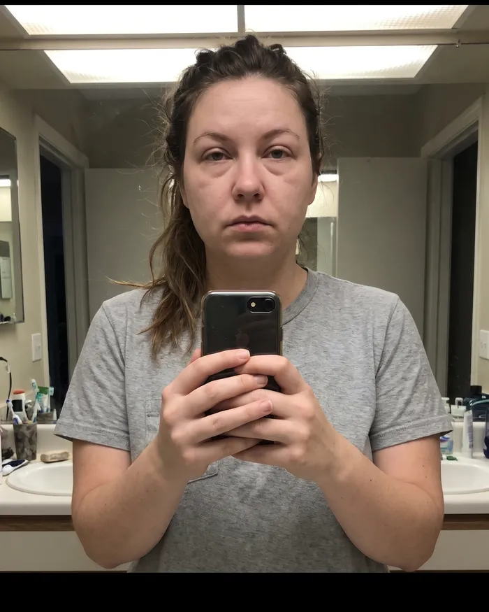 Puffy face in the morning mirror
