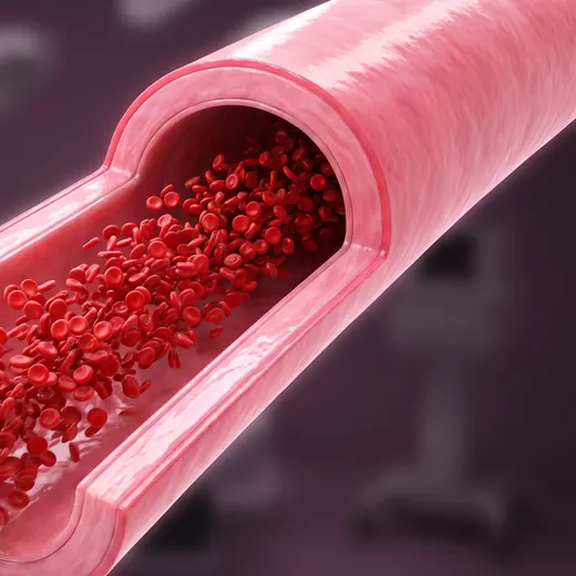 Illustration of a flexible, open artery with strong blood flow