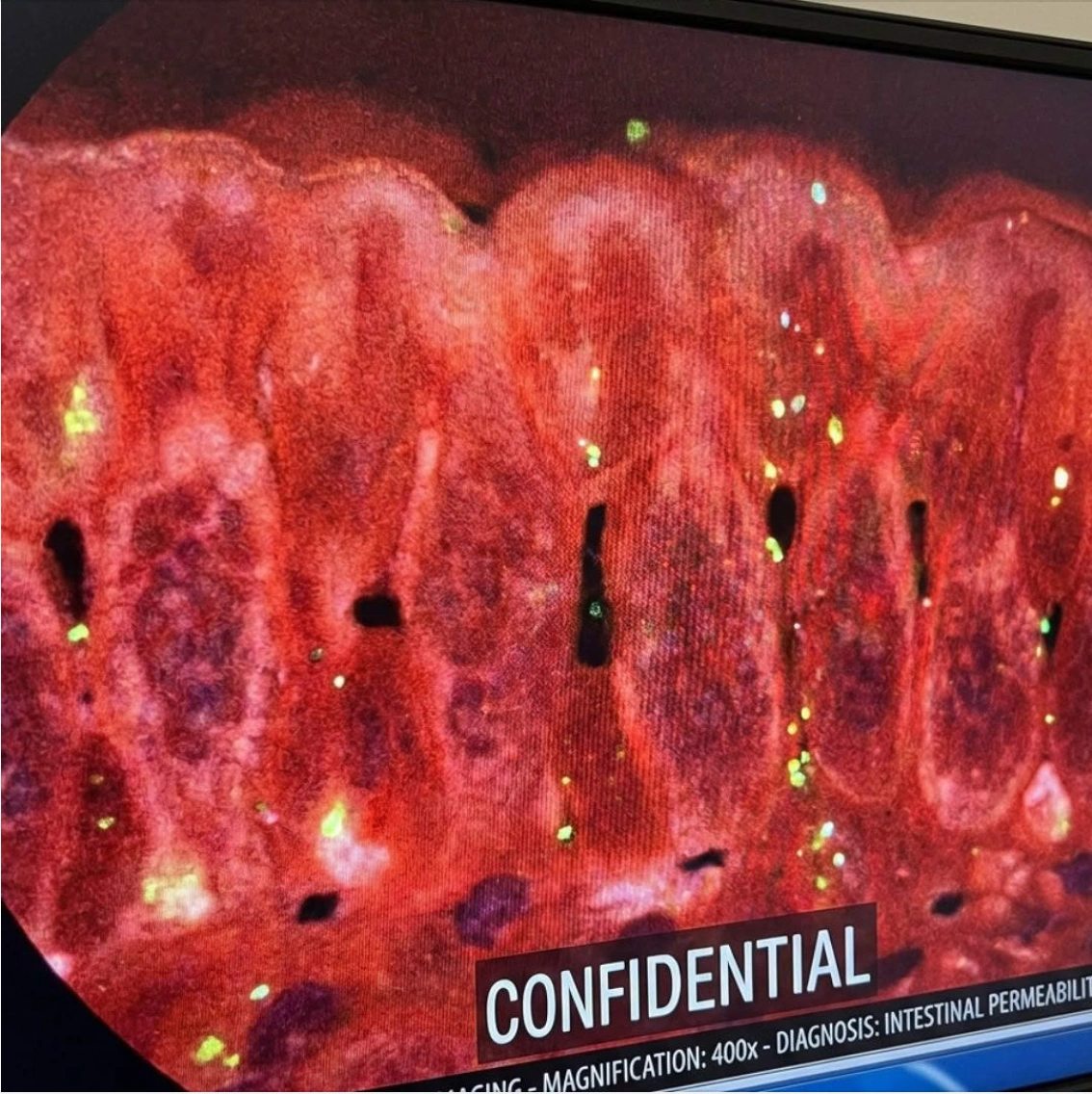 A screen displays a confidential microscopic image of red tissue with small, glowing green and yellow particles.
