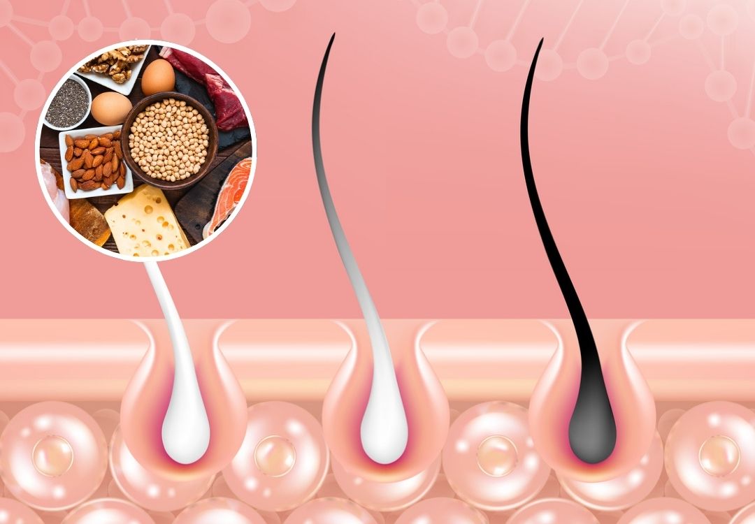 Diagram of hair follicles with a food collage inset.