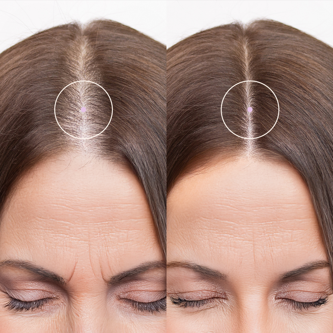 Side-by-side comparison of hair roots with and without gray hairs.