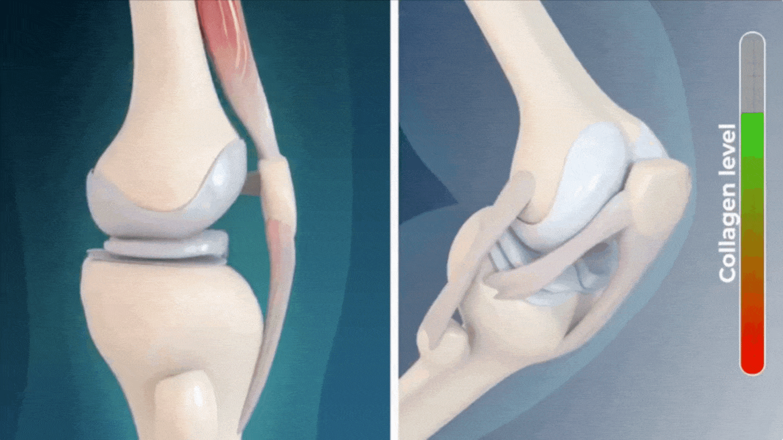 Illustration of a knee joint with collagen level indicator.