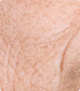 A close-up, magnified view of human skin with fine lines and freckle-like brown spots.