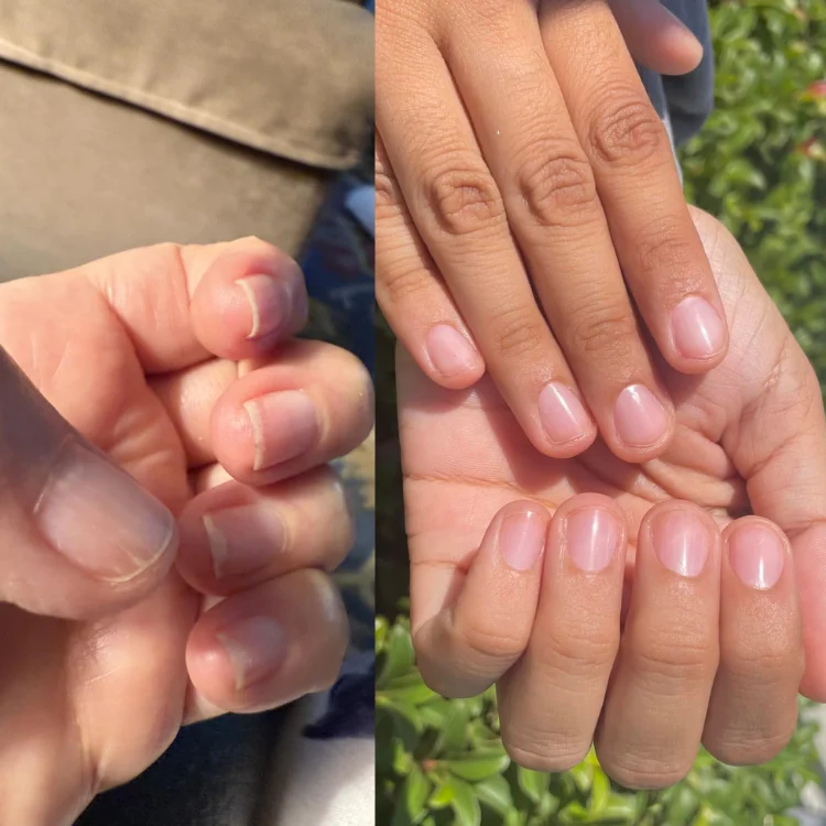 A before-and-after comparison showing short, uneven fingernails on the left and neatly manicured nails on the right.