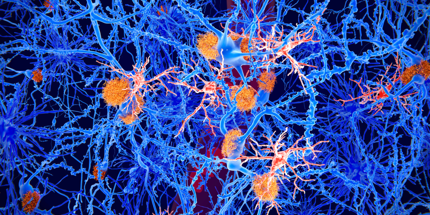 Abstract illustration of blue neurons with orange clusters on a dark background.