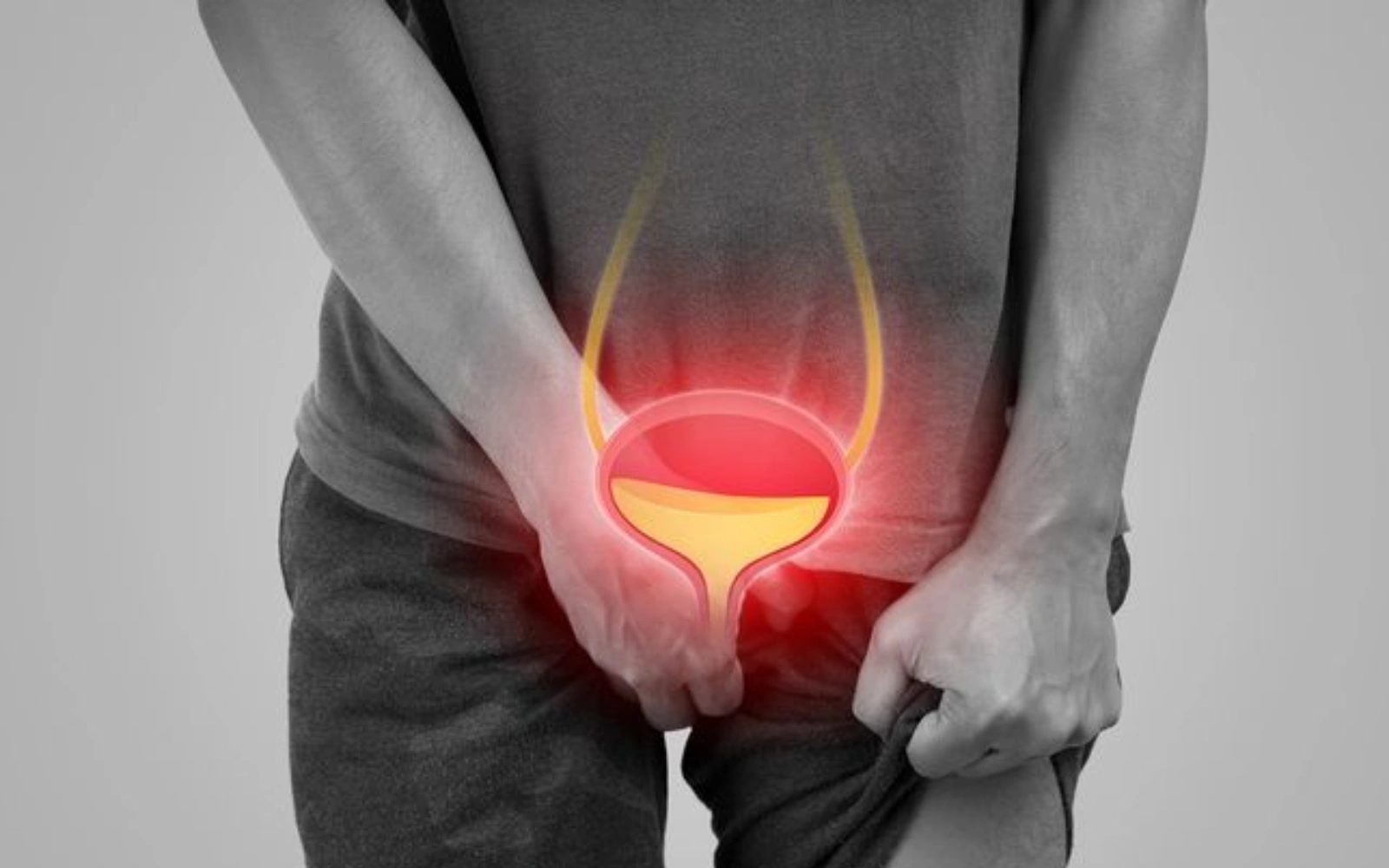 Person holding abdomen, overlay of a highlighted bladder in red.