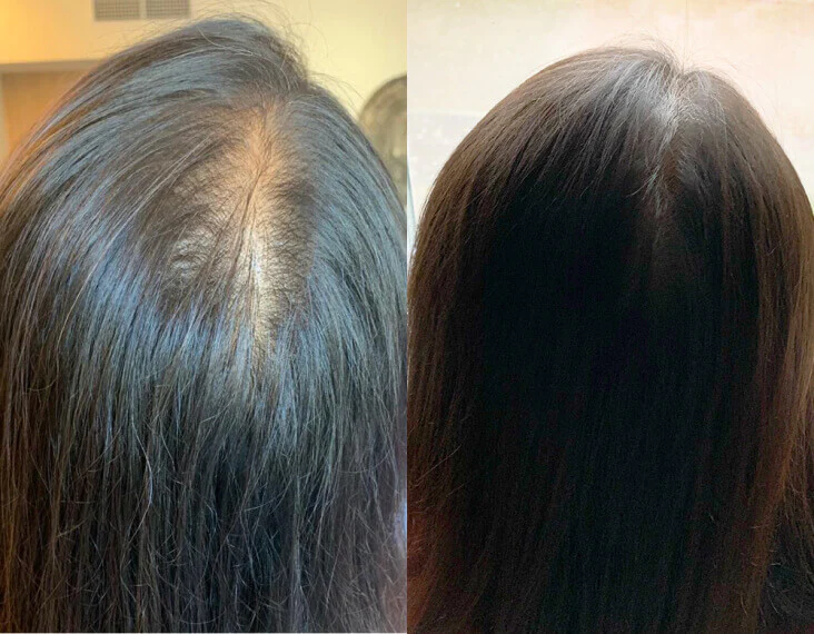 A before-and-after image showing the top of a person's head with thinning hair and then fuller hair.