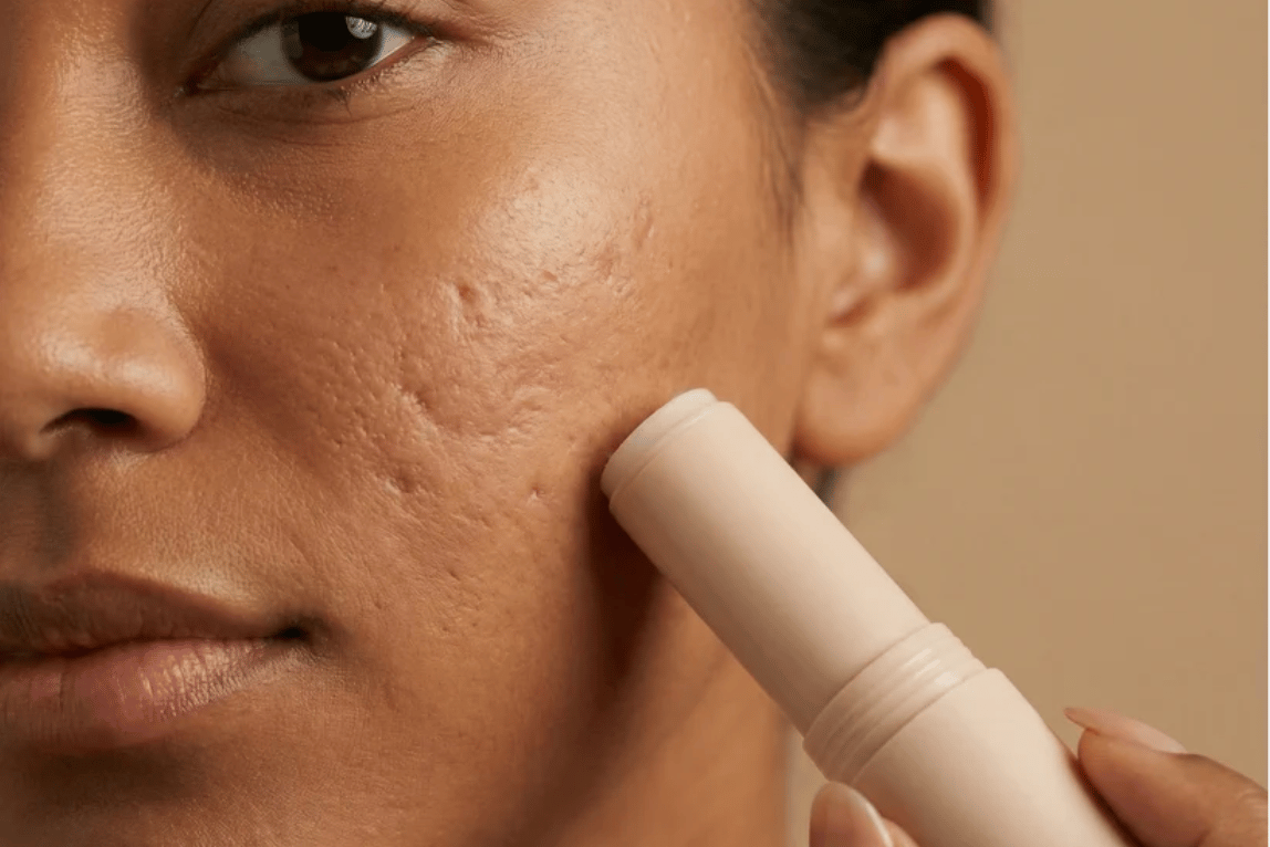 Selvé — Clinical Acne Scar Remodeling Stick