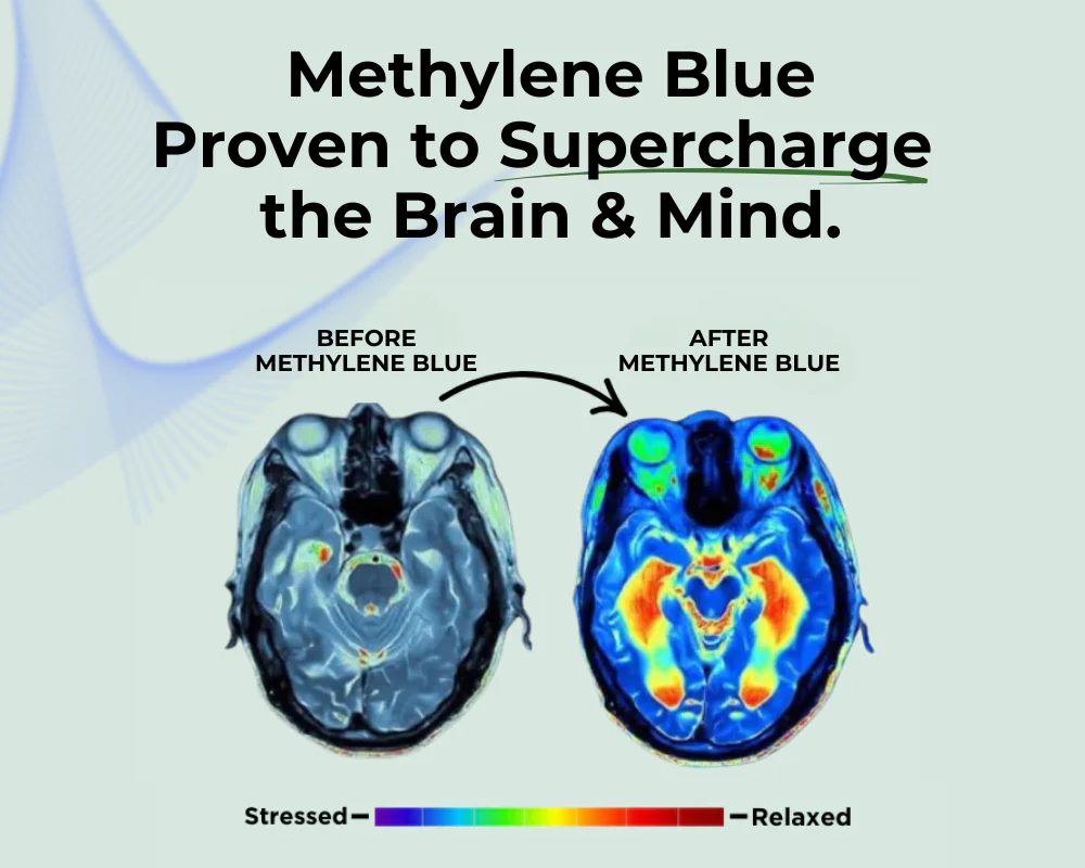 Two brain scans labeled before and after methylene blue treatment.