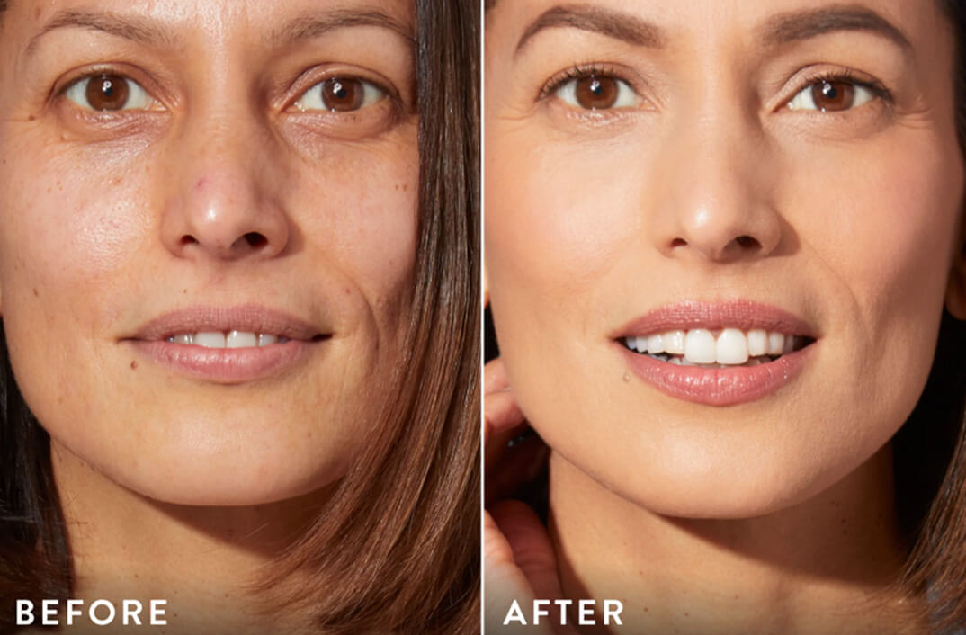 Side-by-side comparison of a woman's face before and after skincare.