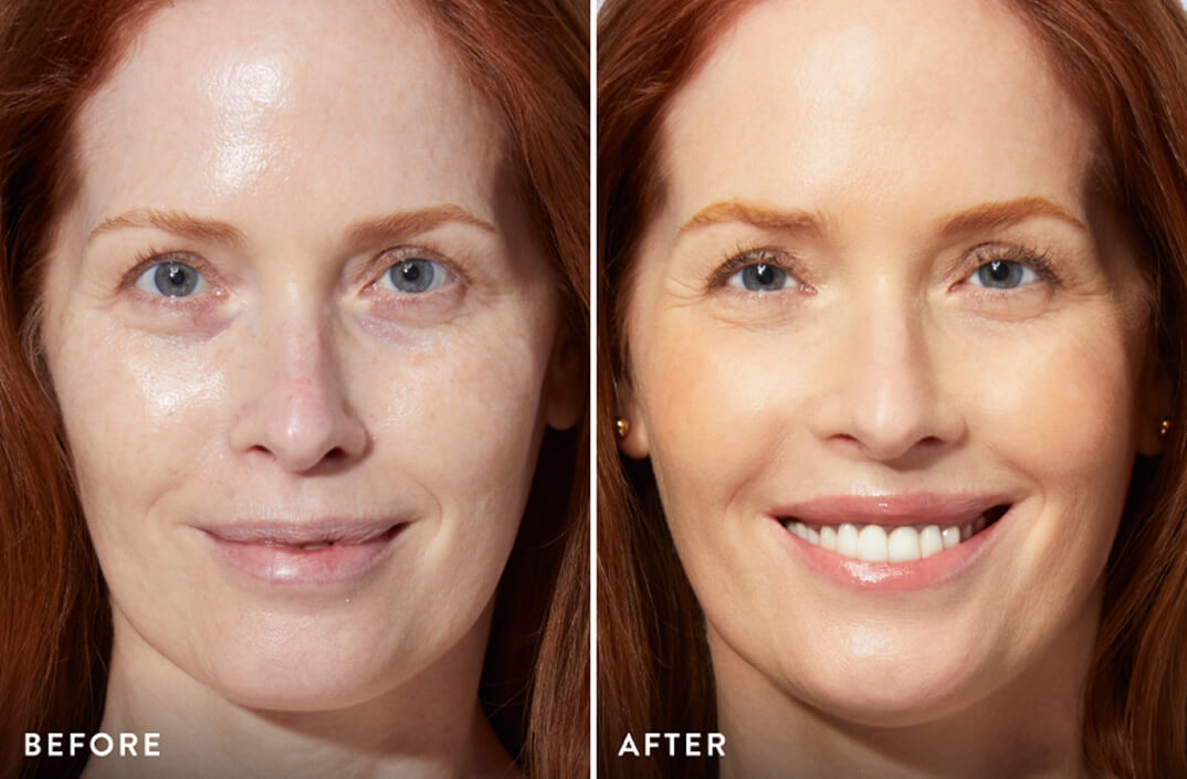 Side-by-side before and after images of a woman's face showing skincare improvement.