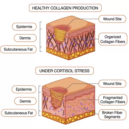 Diagram comparing healthy collagen production with collagen production under cortisol stress in a cross-section of skin.