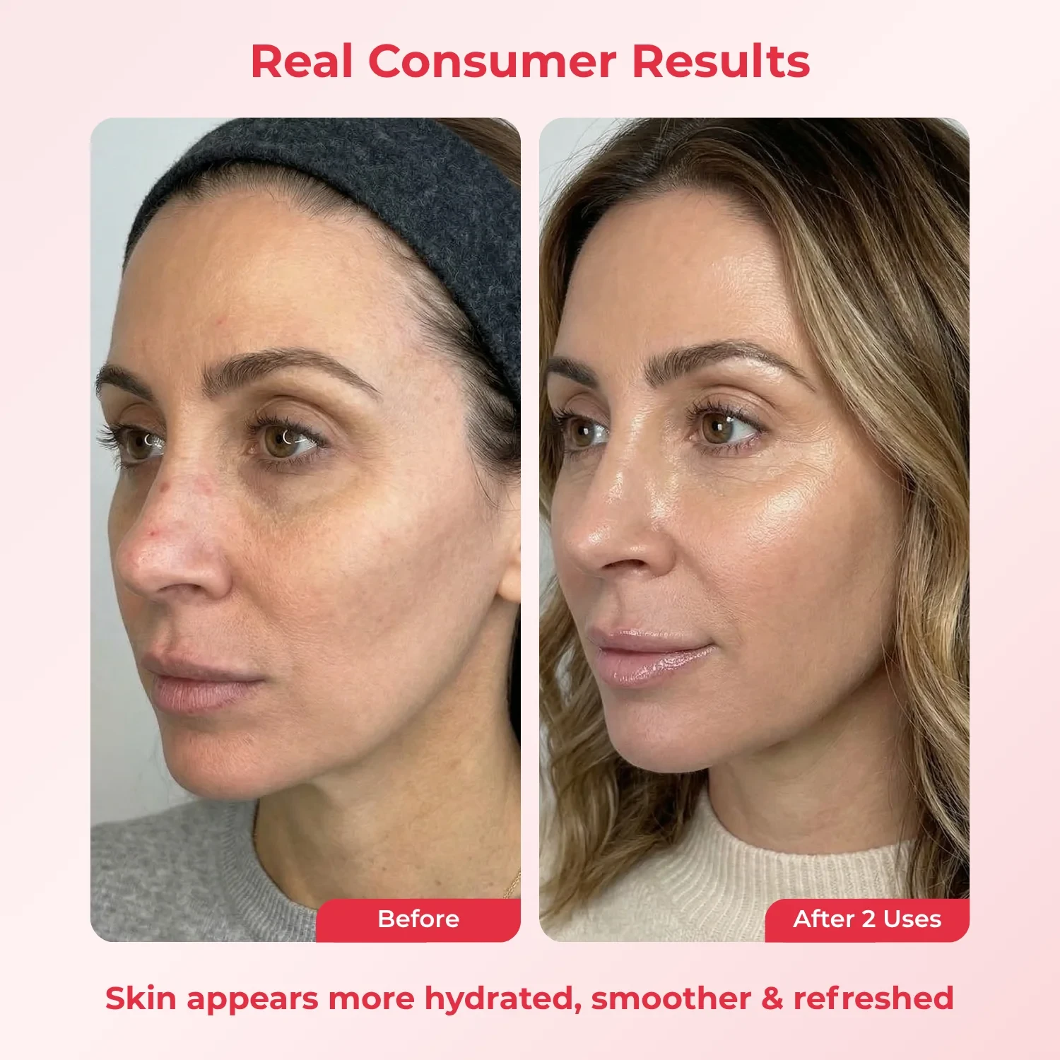 Before and after photos of a woman's face, showing improved skin texture and hydration after two uses.