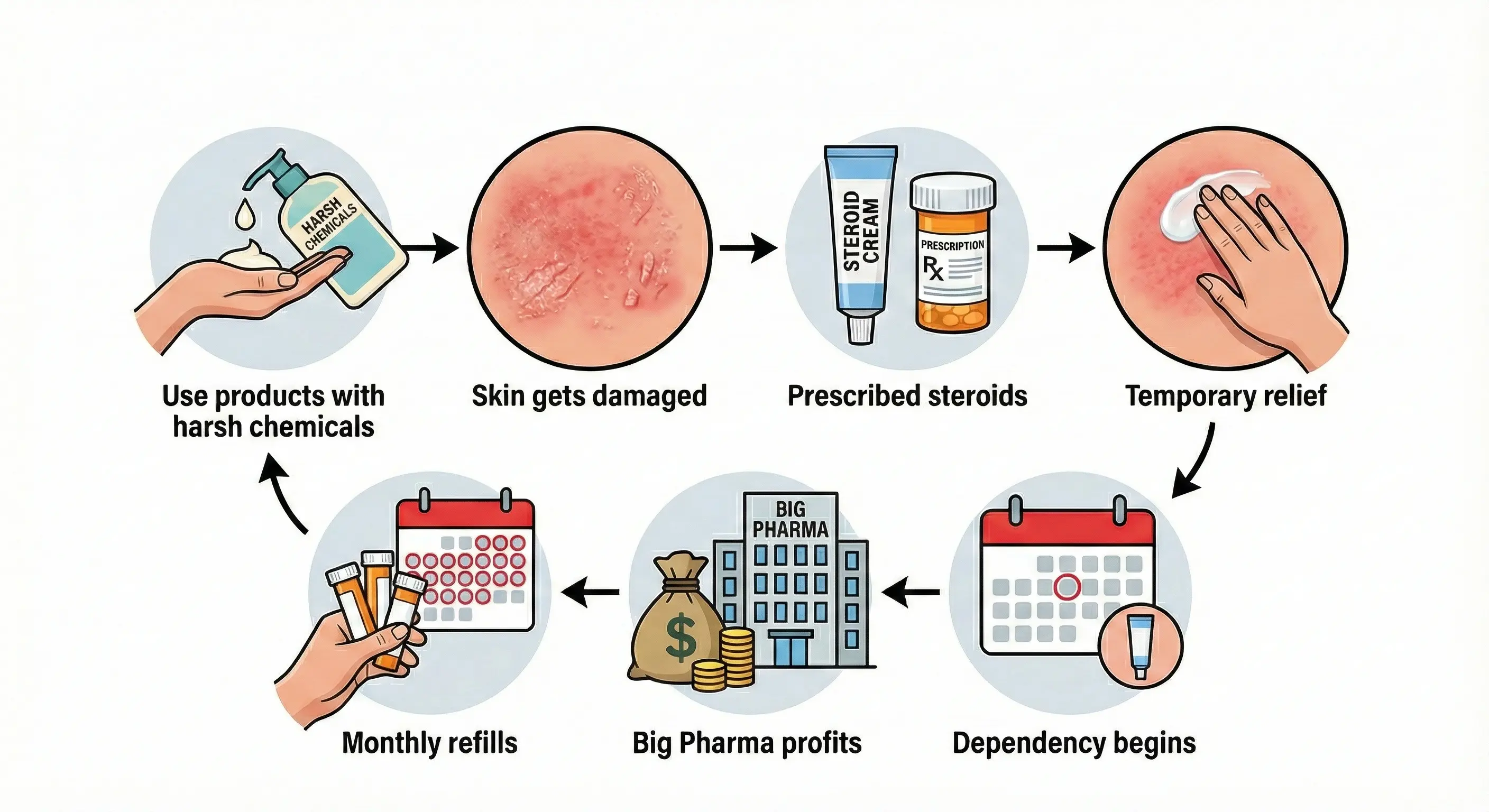 An infographic showing a cycle of skin irritation caused by chemicals, treated with steroids, leading to dependency.