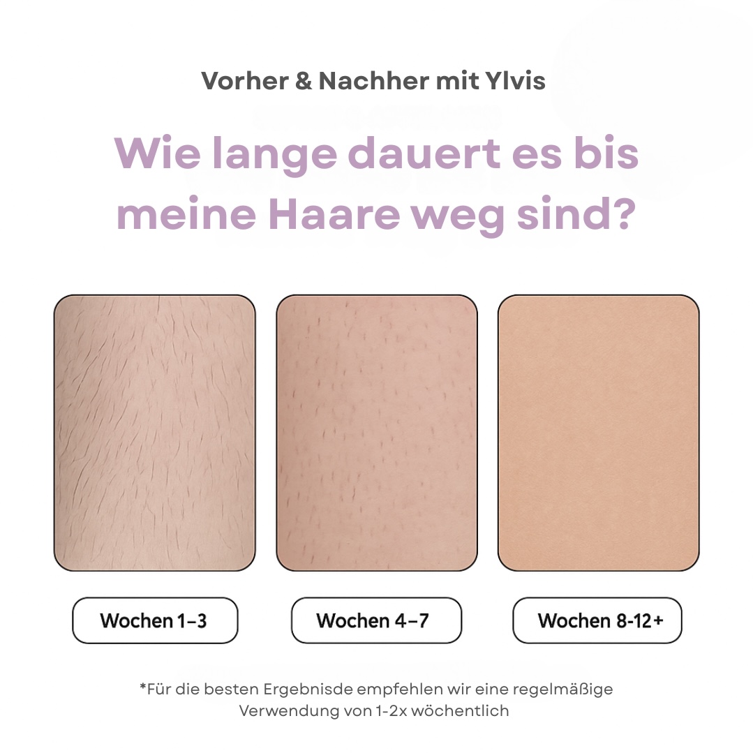 Three images comparing hair growth reduction over weeks 1-3, 4-7, and 8-12+.