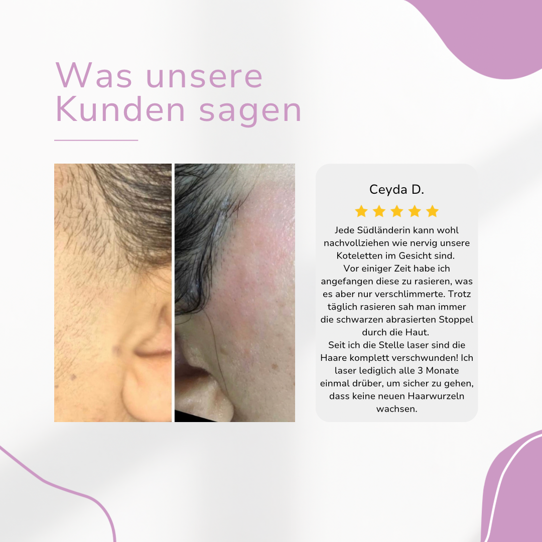 Before and after images of facial hair removal, with a customer review displayed.