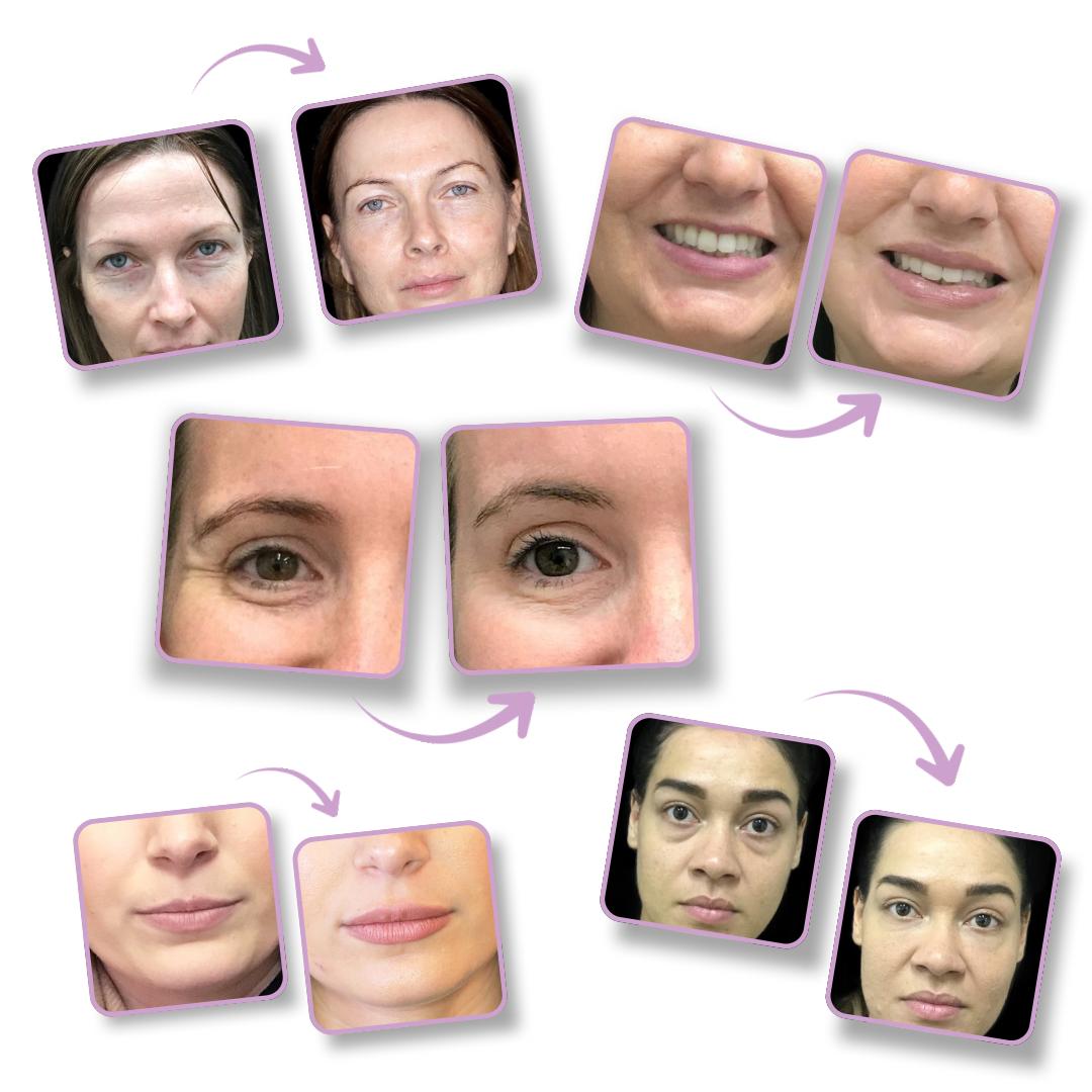 Collage of before-and-after facial close-ups with arrows indicating transformation.