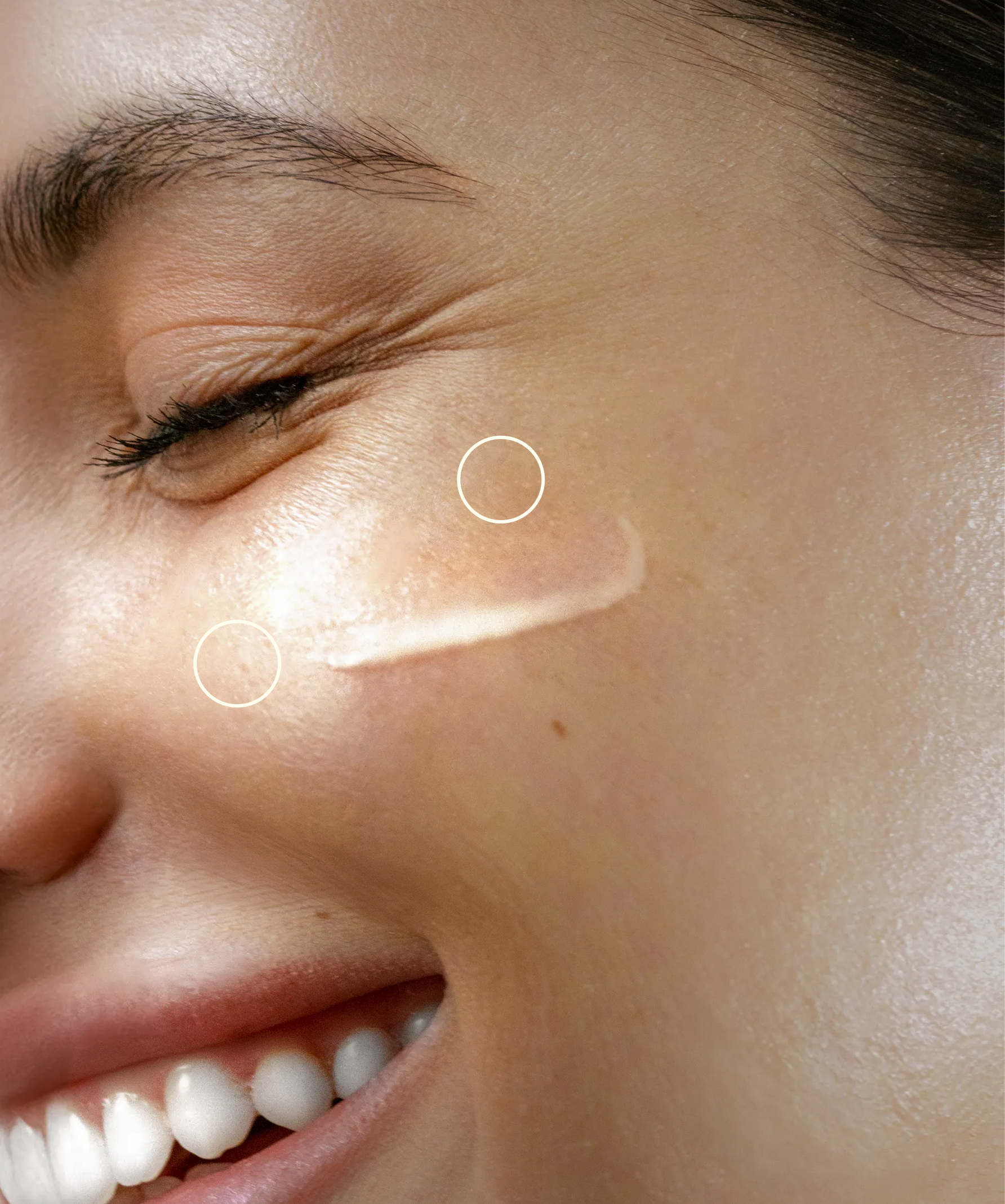 Close-up of a smiling person with cream applied on their cheek.