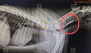 X-ray showing unsafe bone fragments