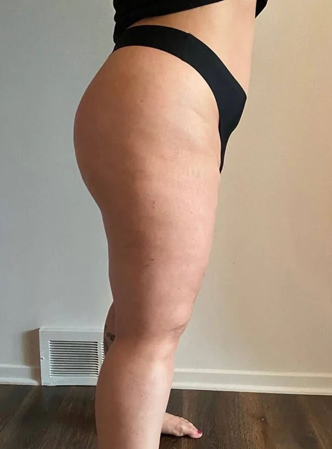 Side view of a person's lower body in black underwear, showing their hip, thigh, and buttock.