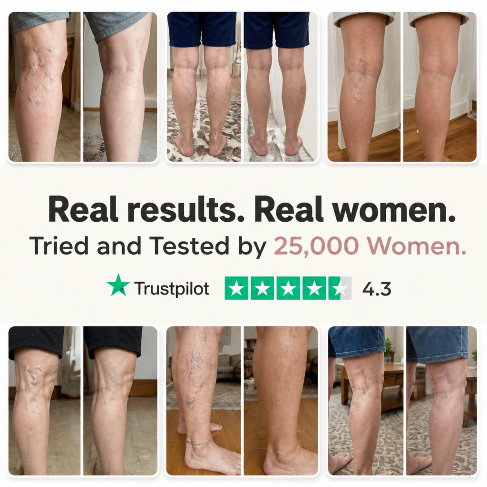 A collage of before-and-after photos showing the reduction of varicose veins on women's legs.