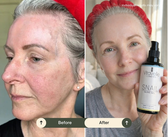 A before-and-after image showing a woman's skin. In the after photo, she holds a skincare product.
