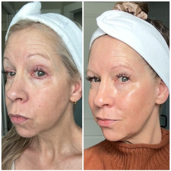 A side-by-side comparison of a woman's face, showing her skin looking more hydrated and radiant in the after photo.