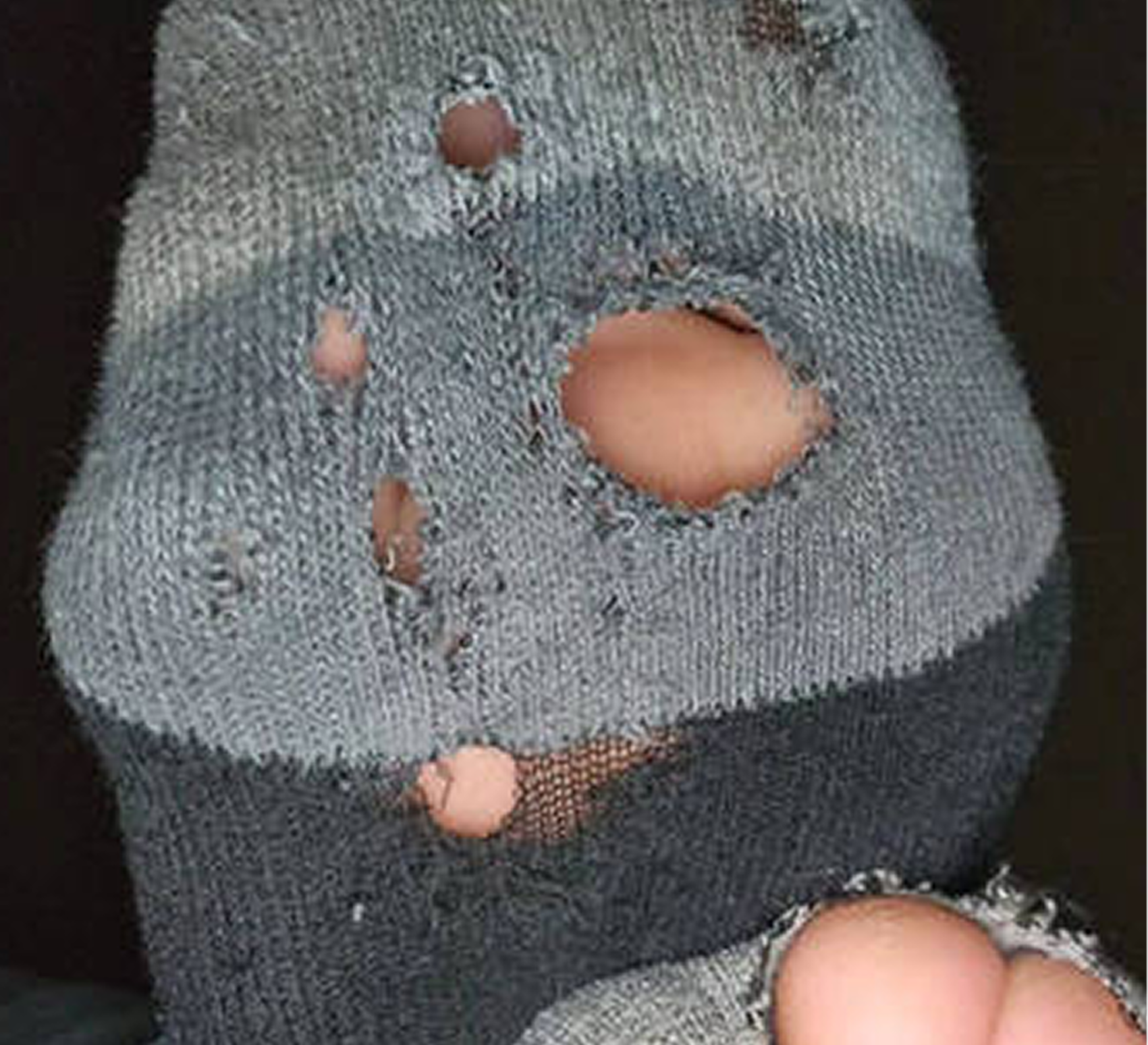 Close-up of a gray sock with multiple holes, revealing toes.
