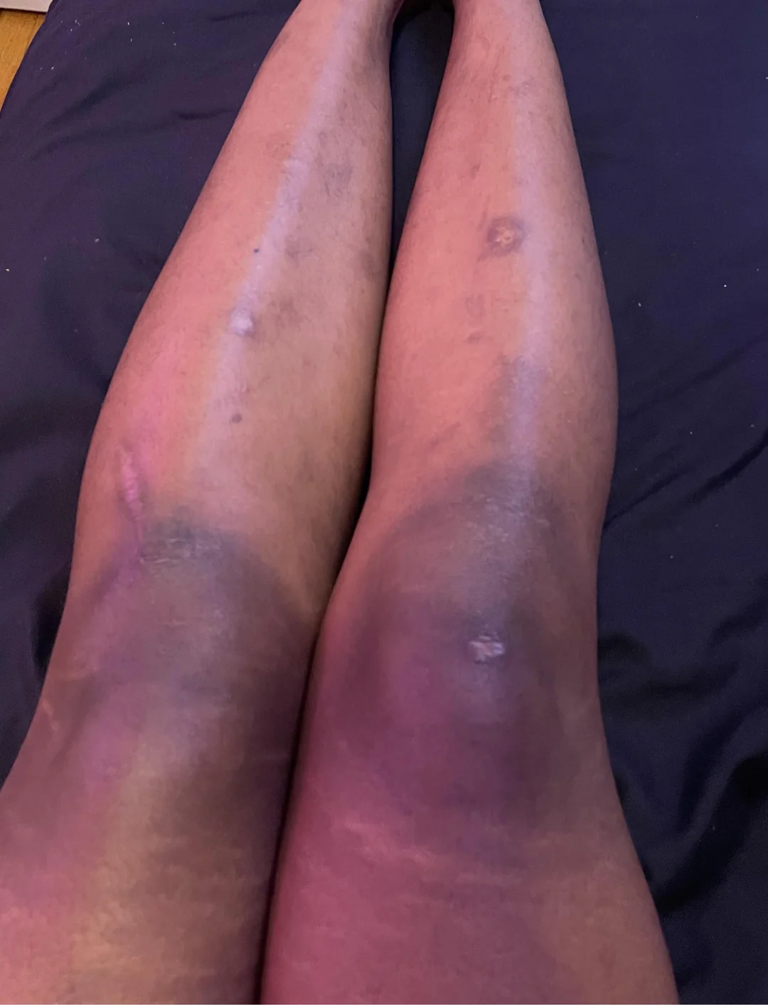 This is how my legs looked