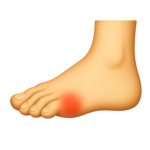 Illustration of a foot with a red, inflamed area near the toes.