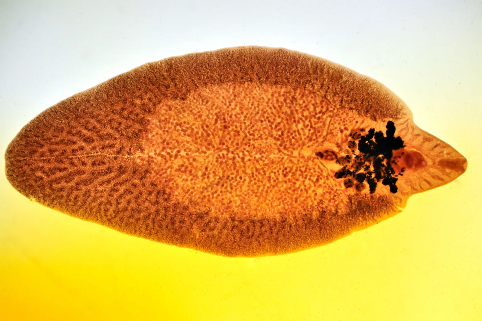 A microscopic view of a brown, leaf-shaped liver fluke on a yellow and white background.