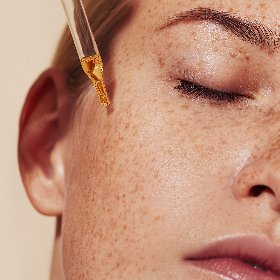 A close-up of a golden serum being applied with a dropper to a person's freckled face.