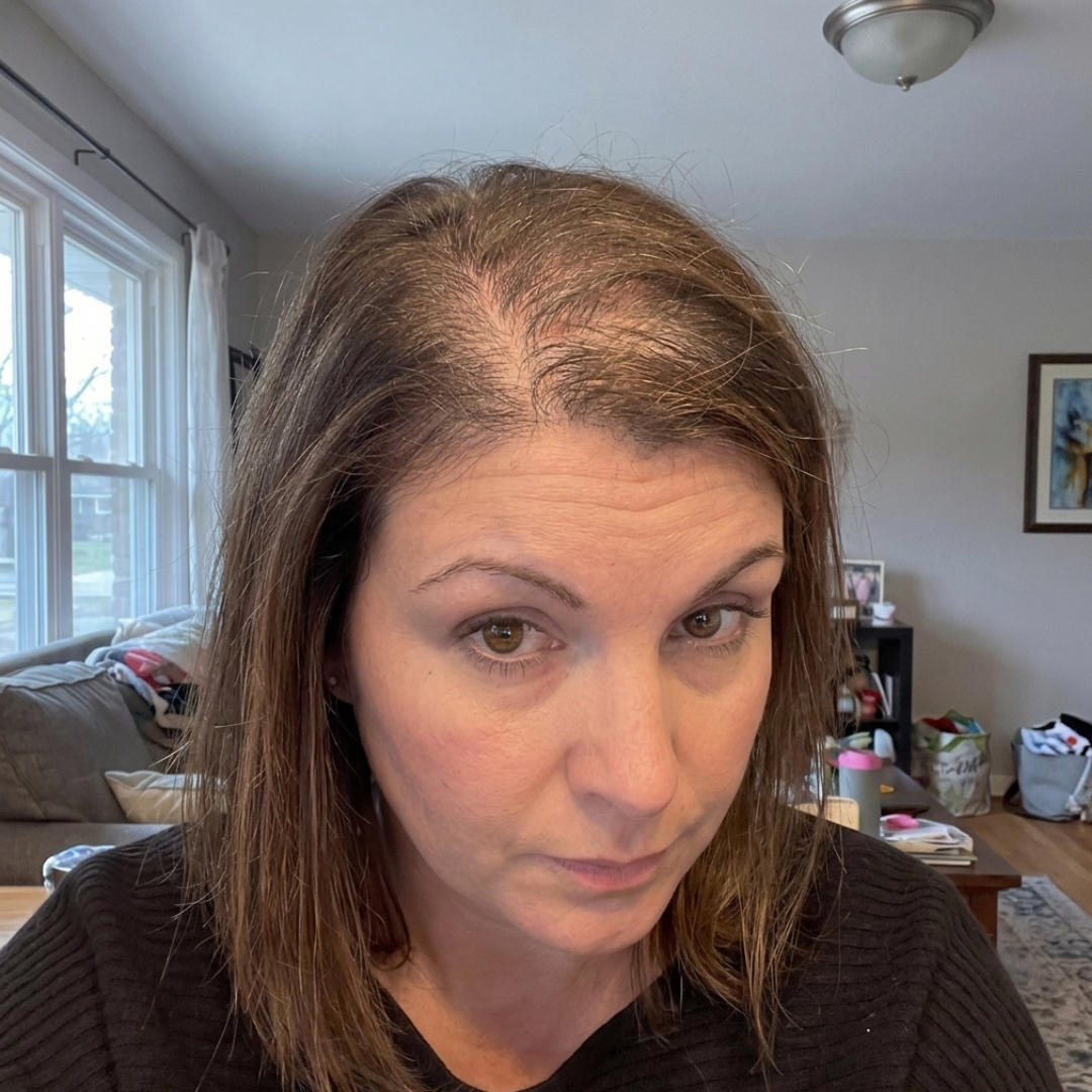 Before — Jennifer R.