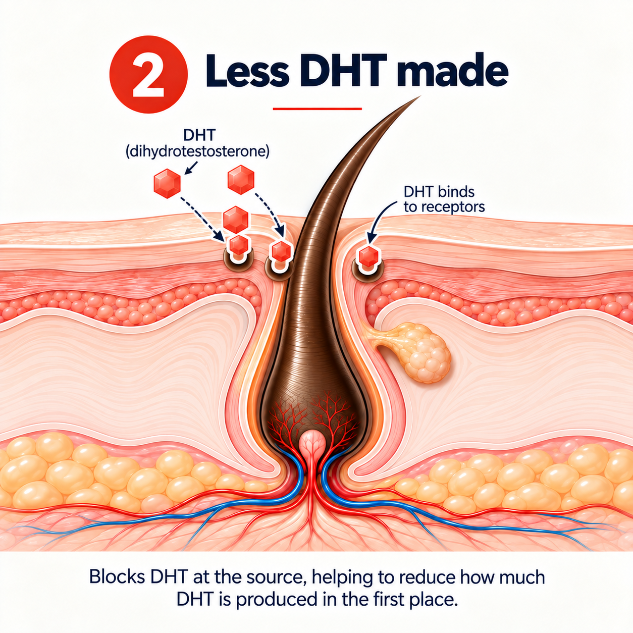 A medical illustration of a hair follicle showing how DHT molecules bind to receptors in the skin.