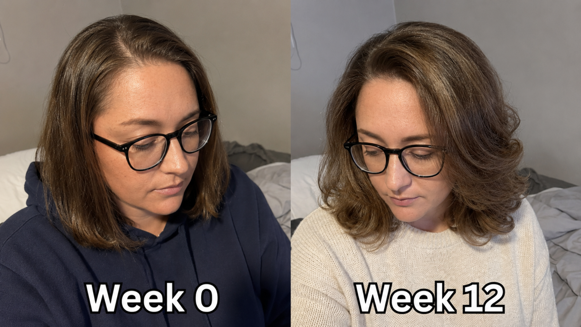 Top down view of a thinning part at week 0 next to fuller, shaped hair at week 12
