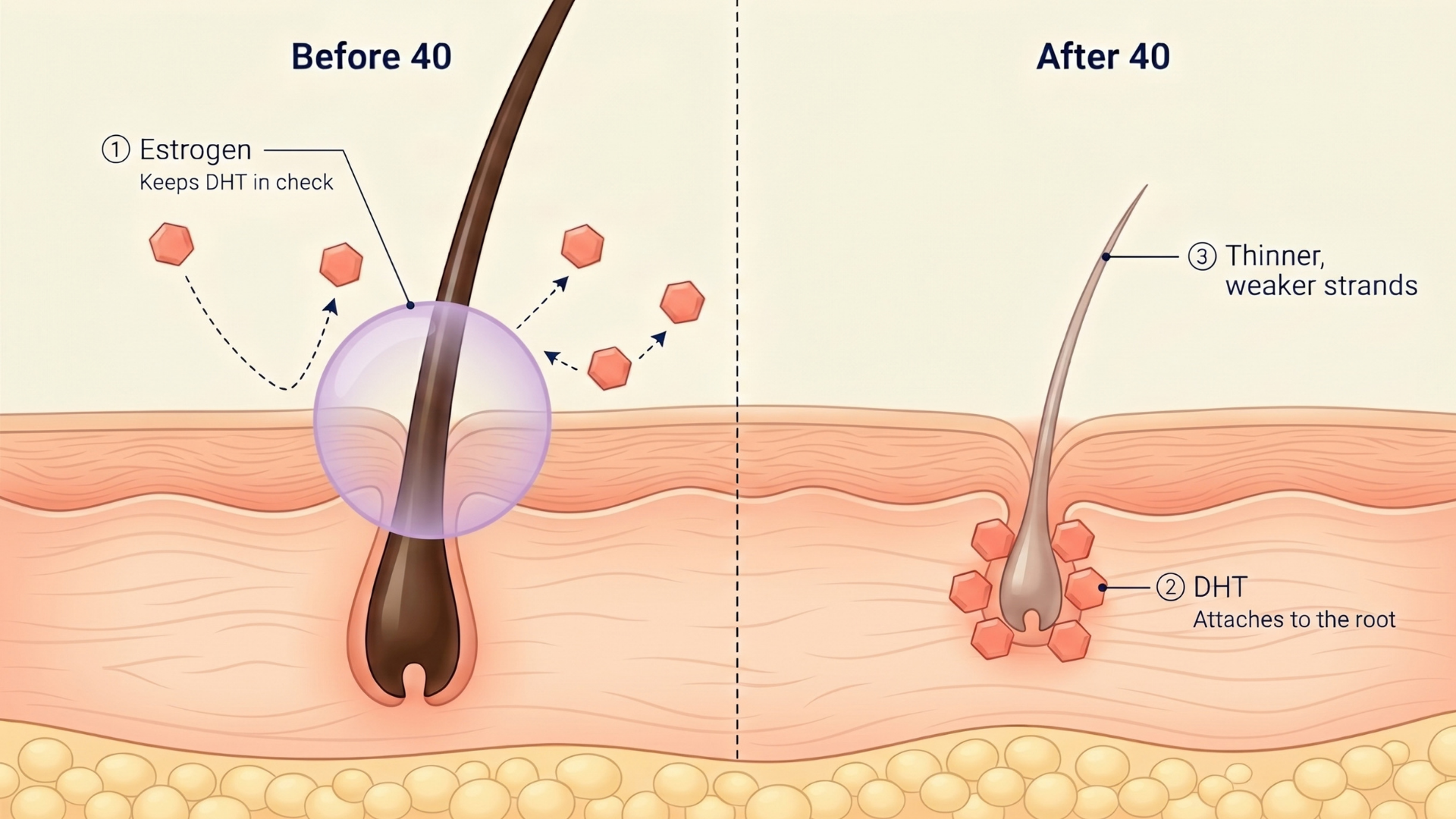 An illustration comparing a hair follicle before and after age 40, showing the effects of estrogen and DHT.