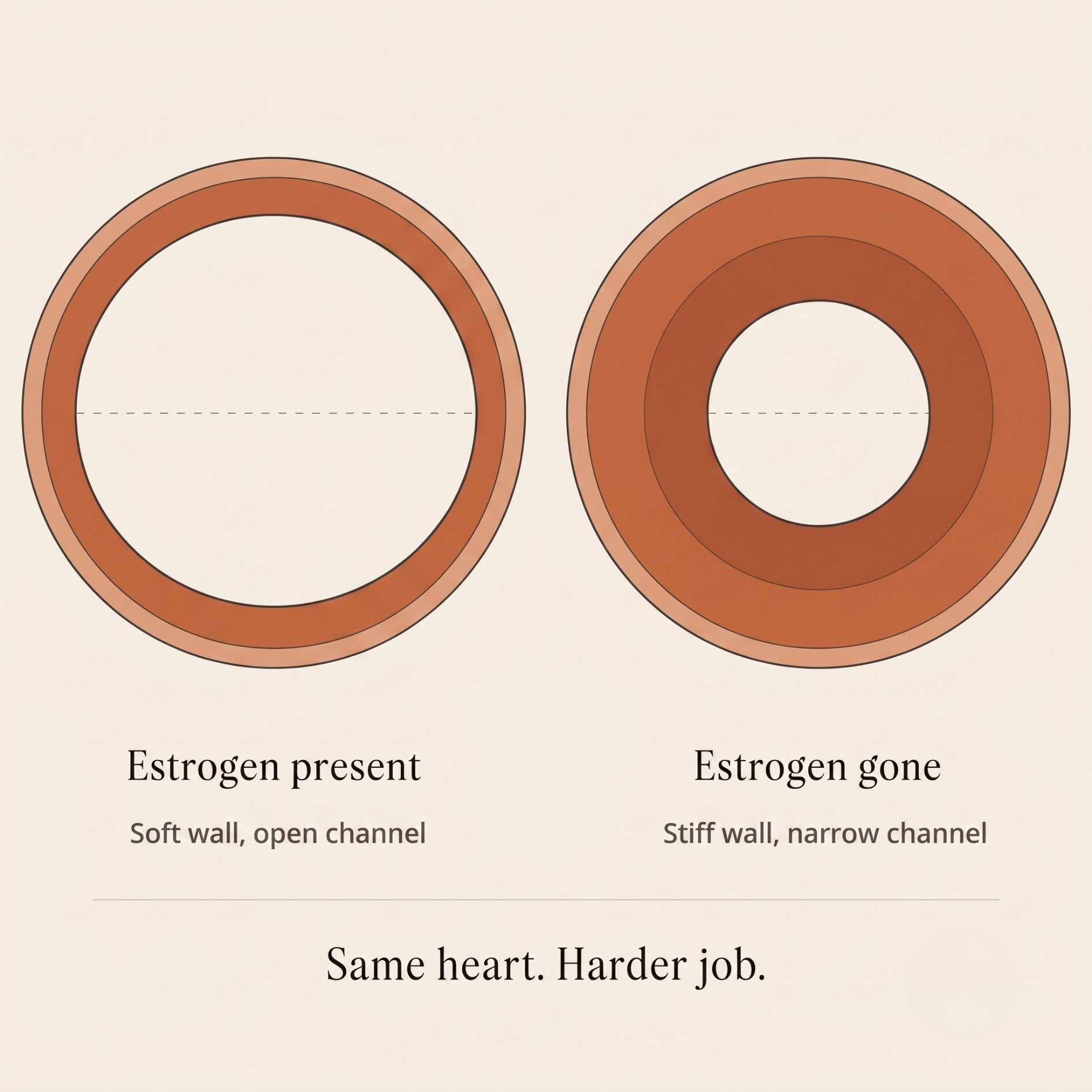 Diagram comparing a channel with estrogen (open) to one without (narrow), showing stiffening walls.