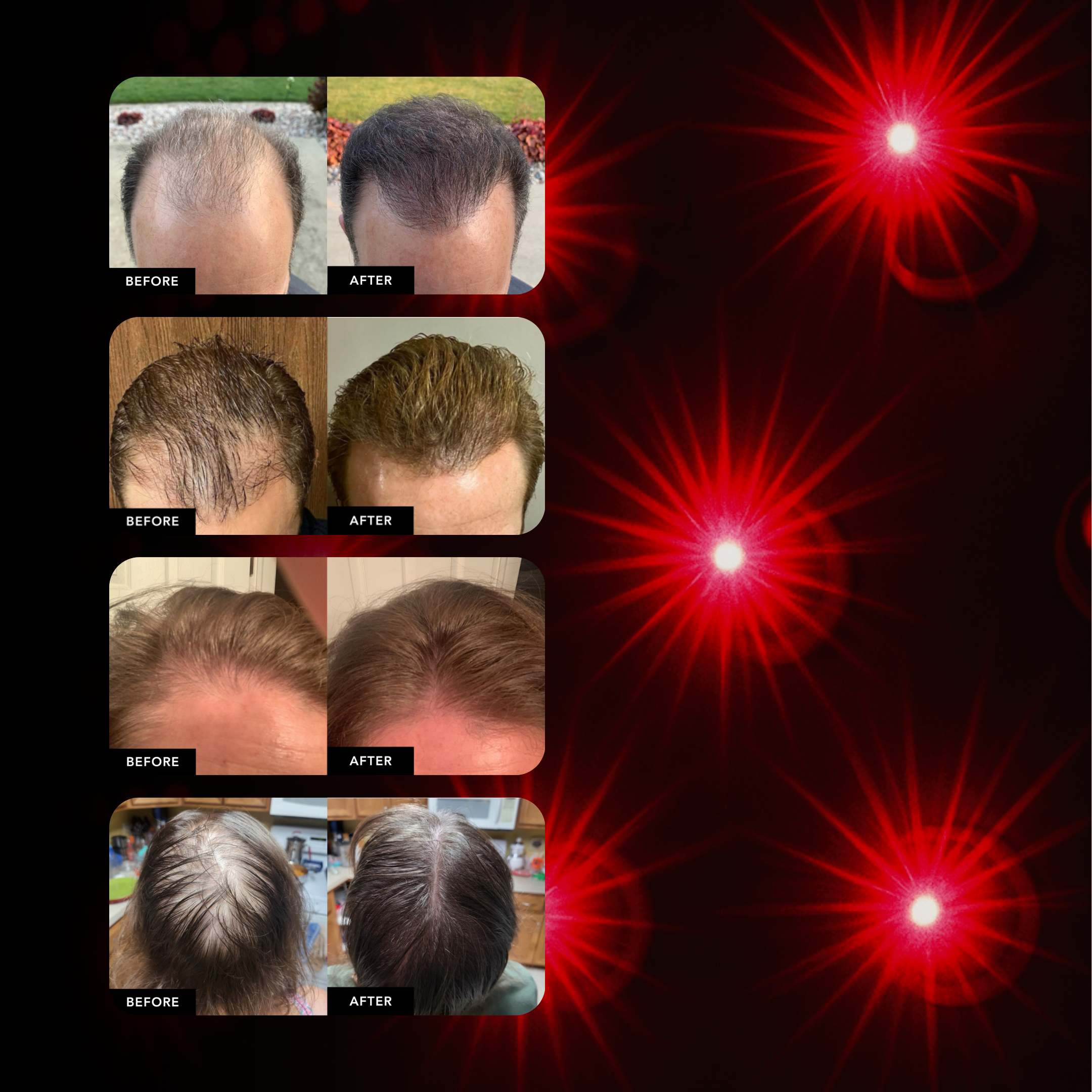 Collage of before and after hair growth photos with red light design background.
