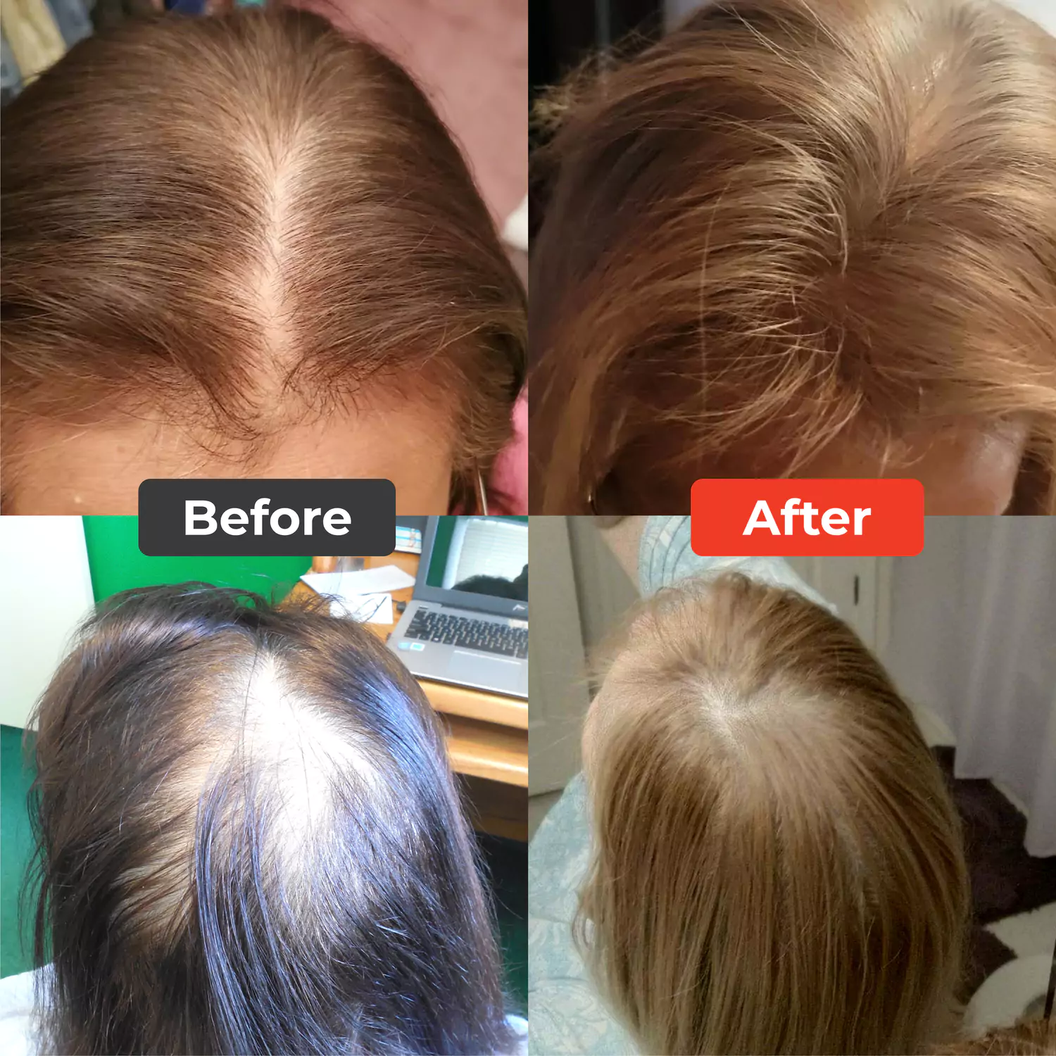 Four images showing hair before and after treatment, labeled 'Before' and 'After.'