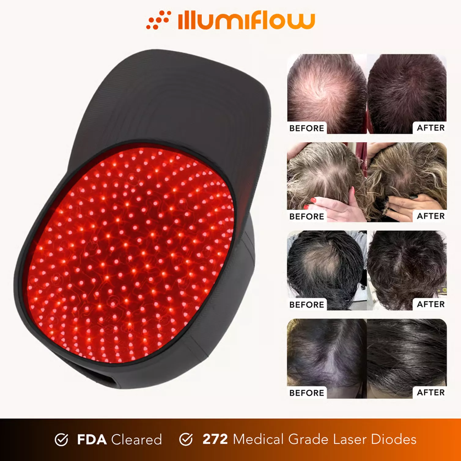 An illumiflow laser cap with red diodes next to four before and after photos of hair regrowth.
