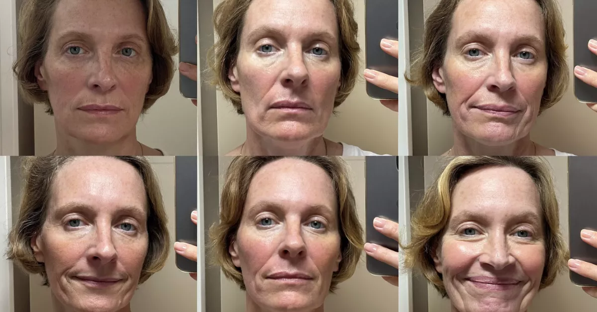 A collage of six photos showing a woman's face with different expressions and skin texture.