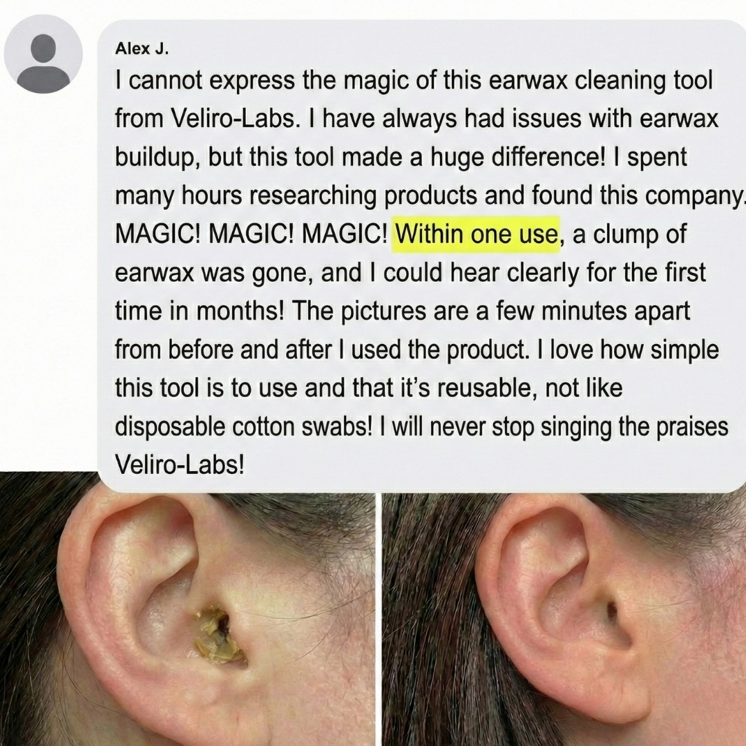 A customer testimonial with before-and-after photos of an ear being cleaned of earwax.