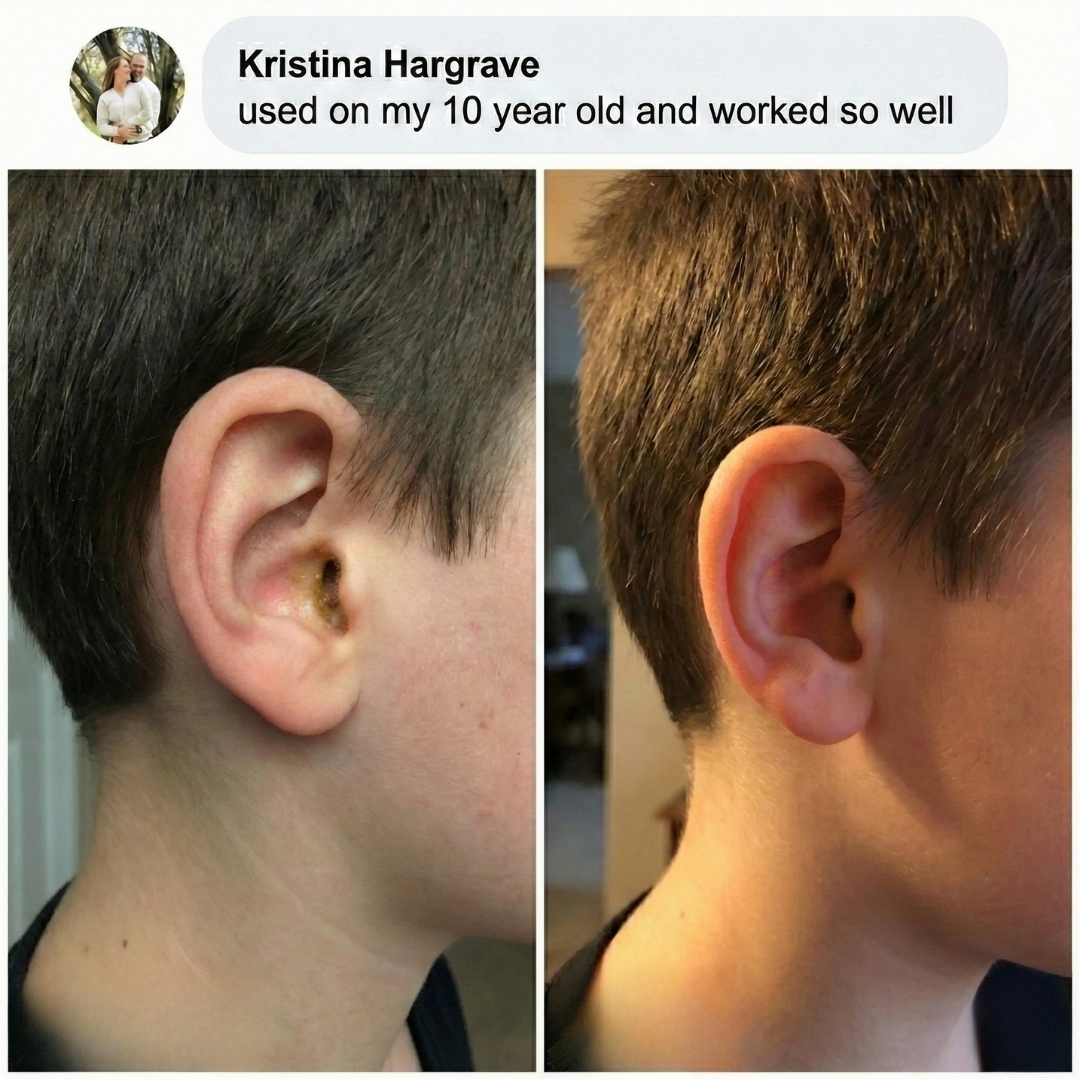 A before-and-after photo showing a child's ear with earwax, and then the same ear clean.