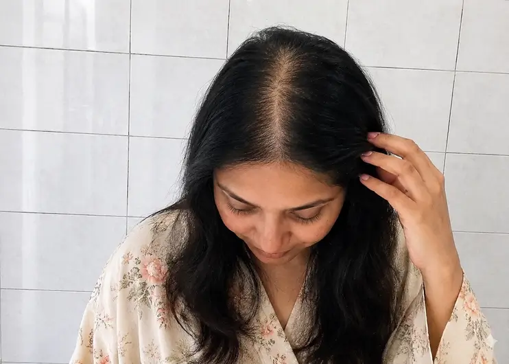 Woman touching her hair beside a visibly fuller center part.