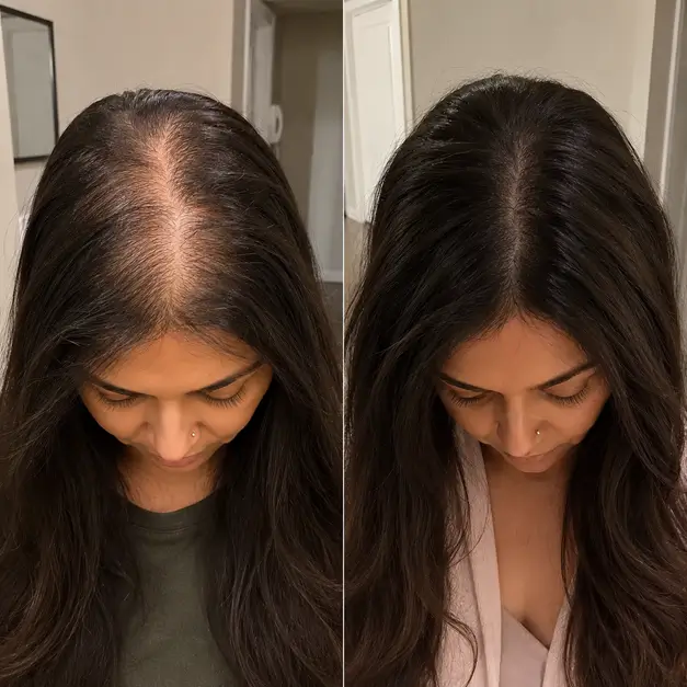 Before-and-after comparison showing fuller-looking hair along the part.